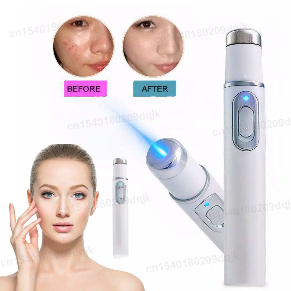 Acne Light Therapy Pen - Terapia della luce blu Penna per